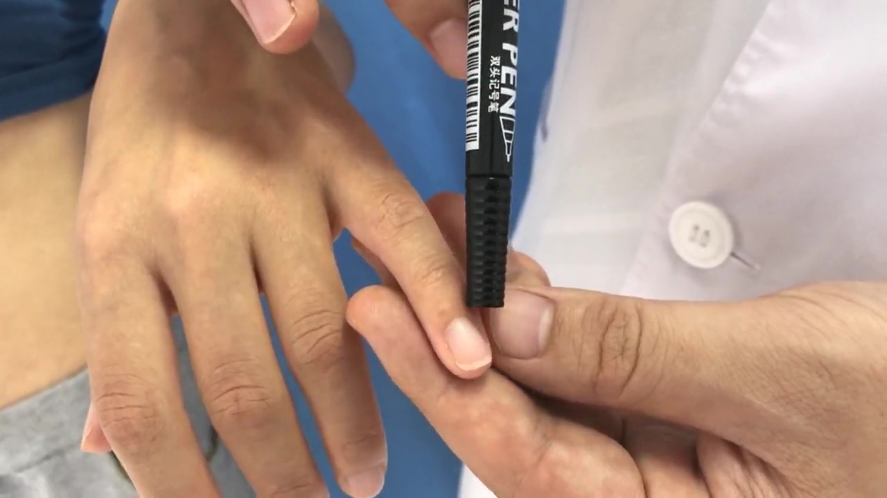 少泽穴