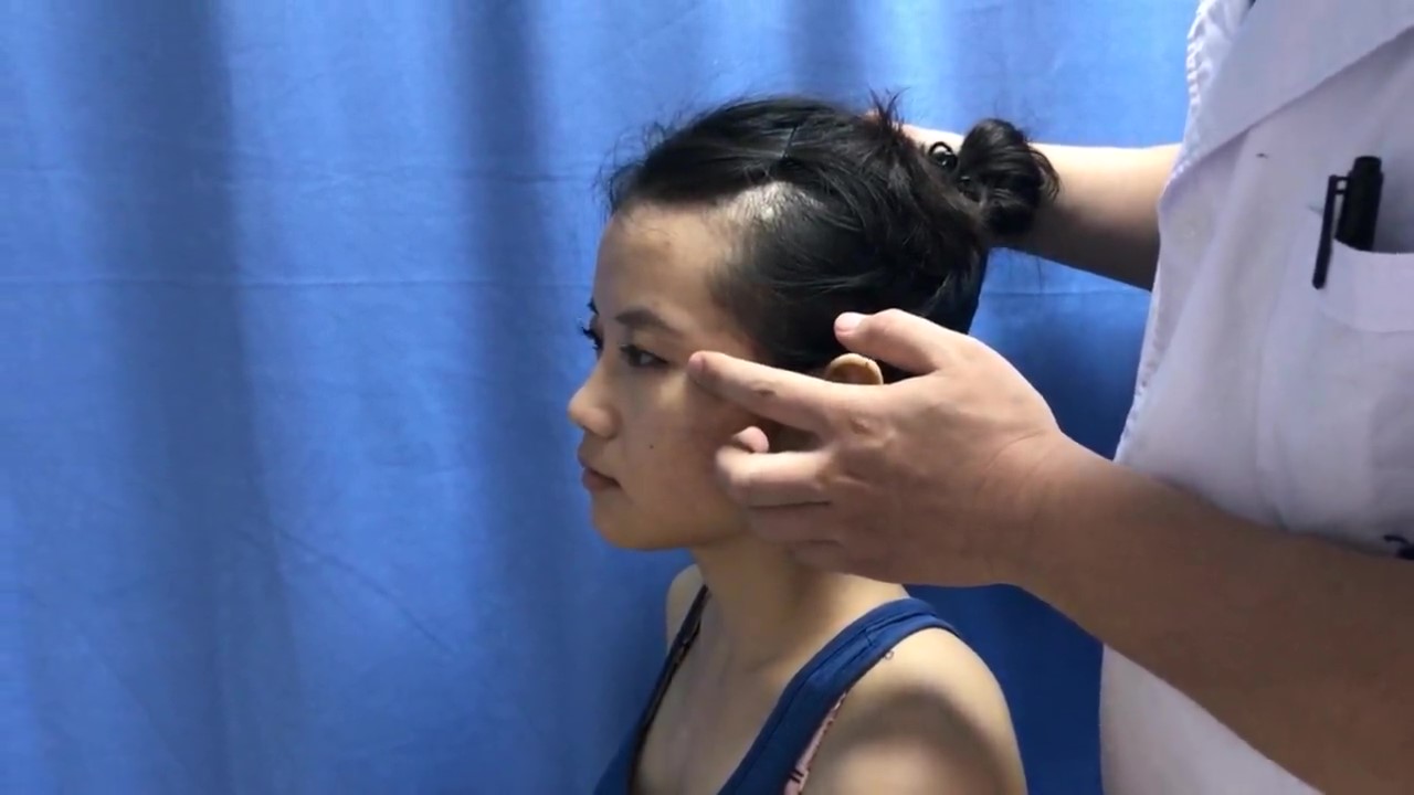 瞳子髎穴