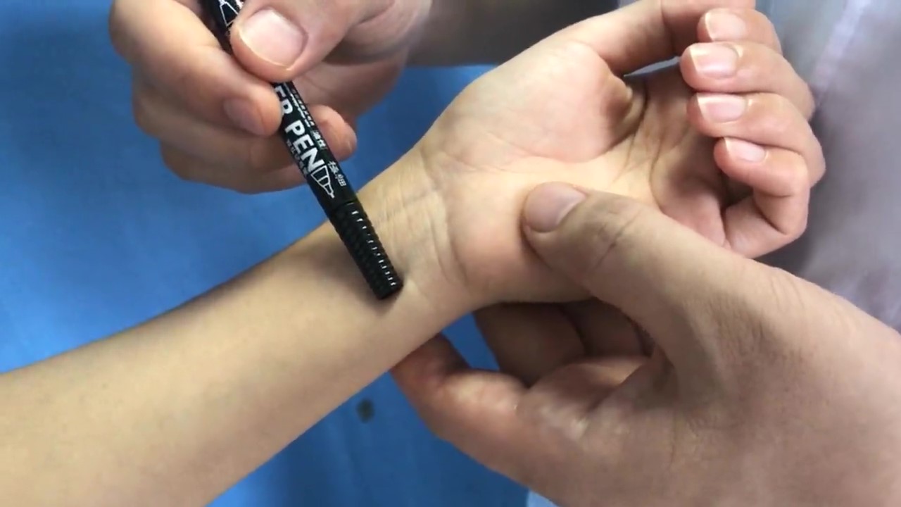 通里穴