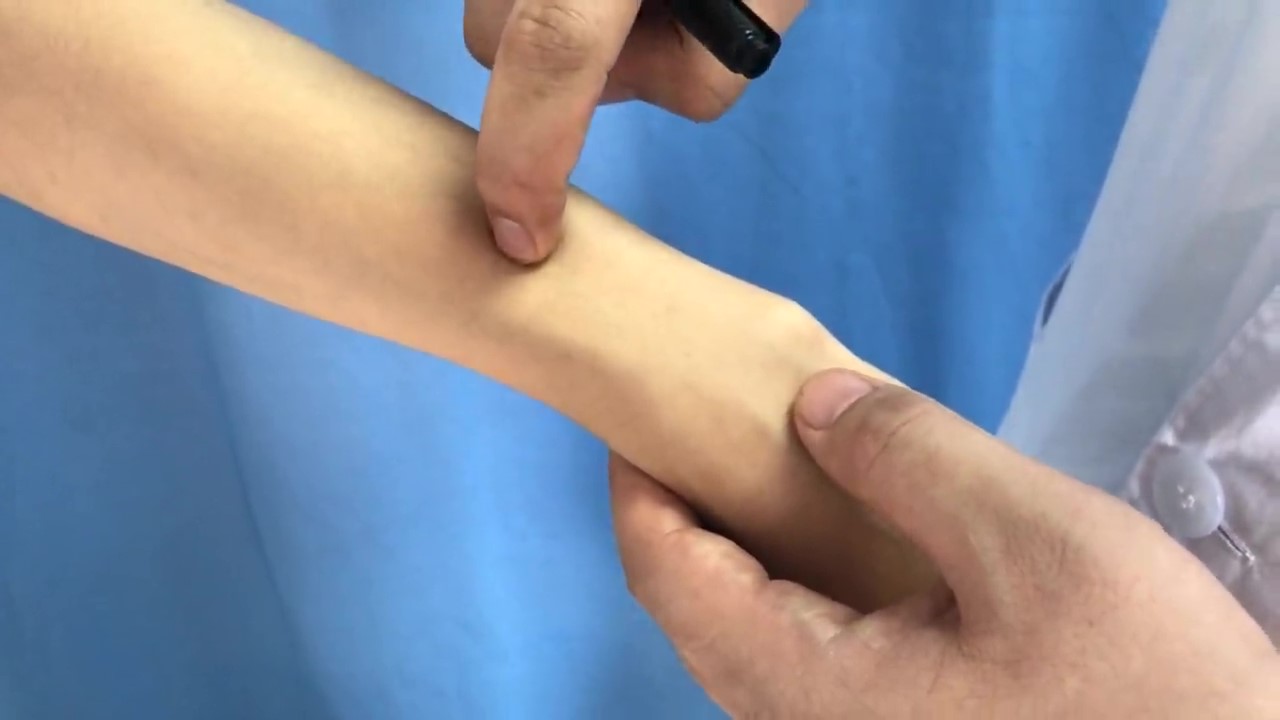 支沟穴
