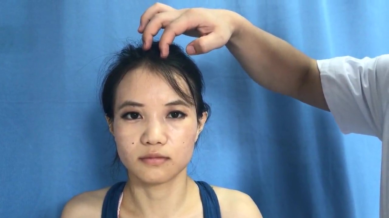 曲差穴