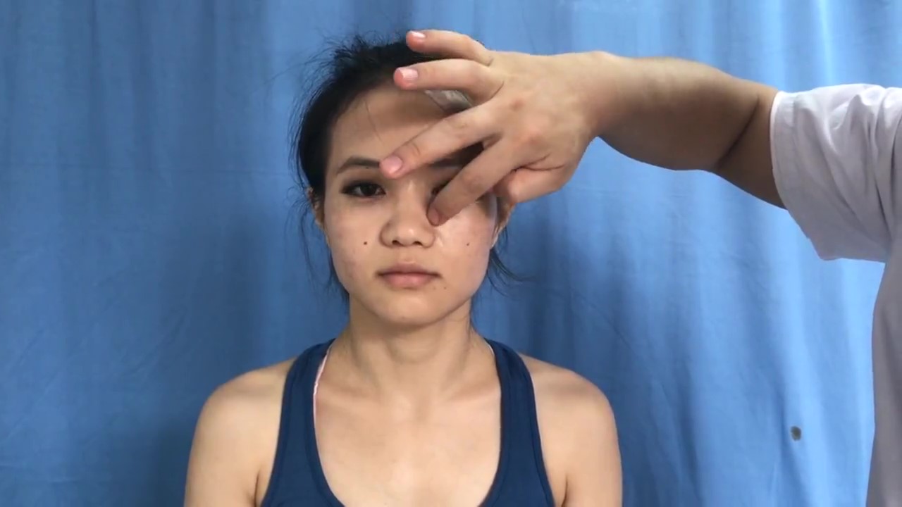 上迎香穴