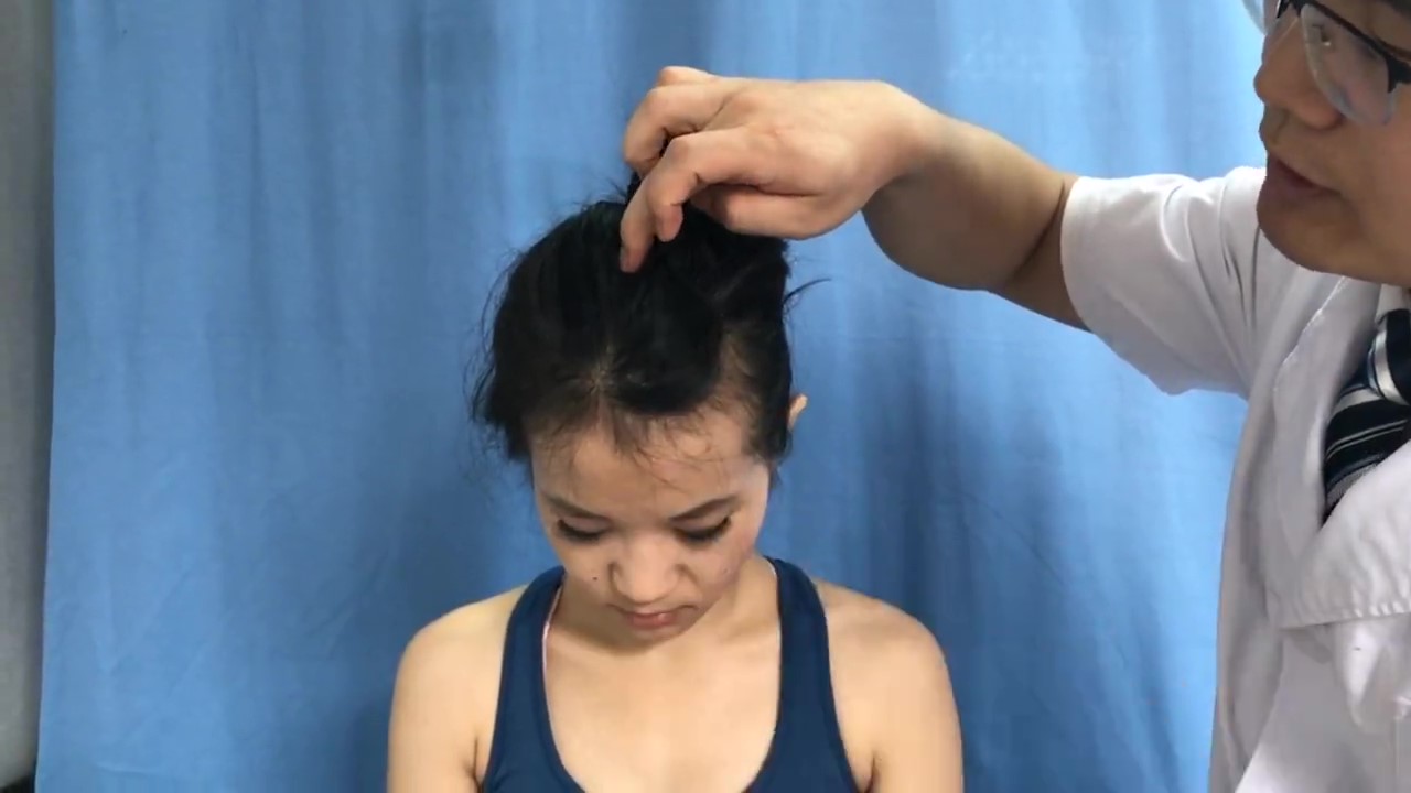 前顶穴