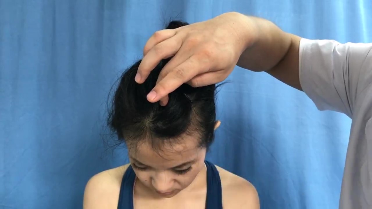 囟会穴