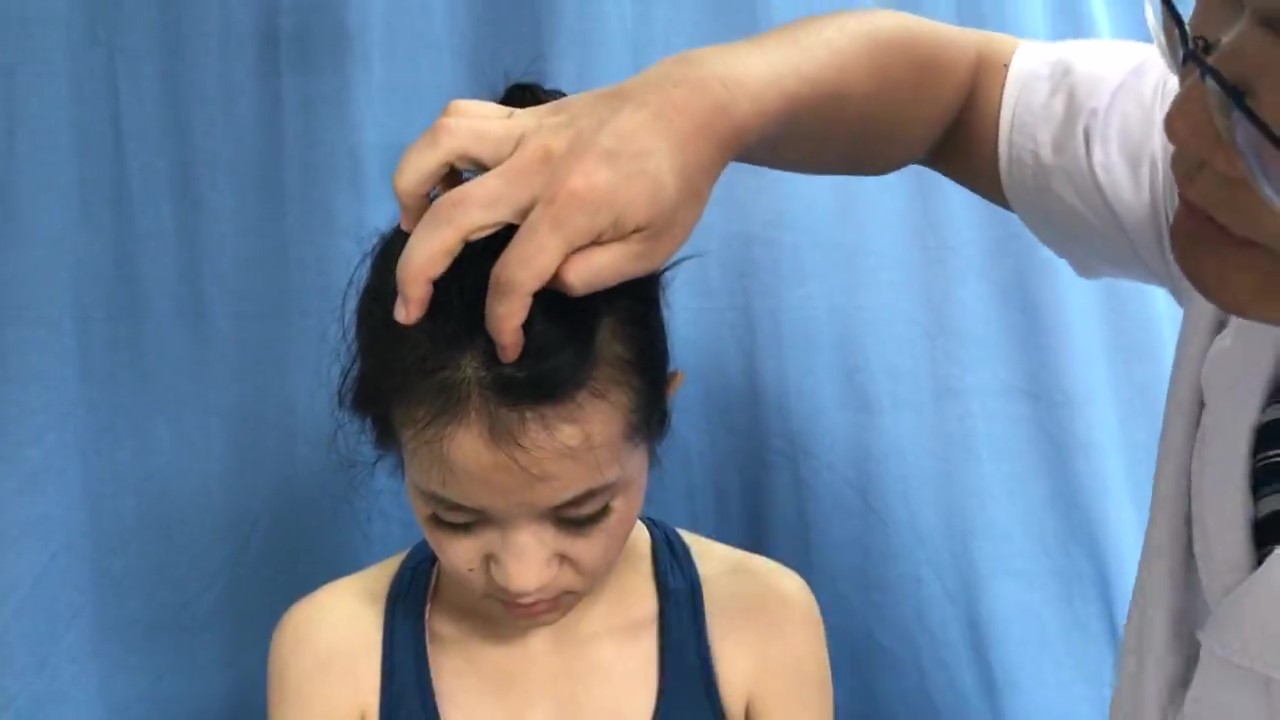 上星穴