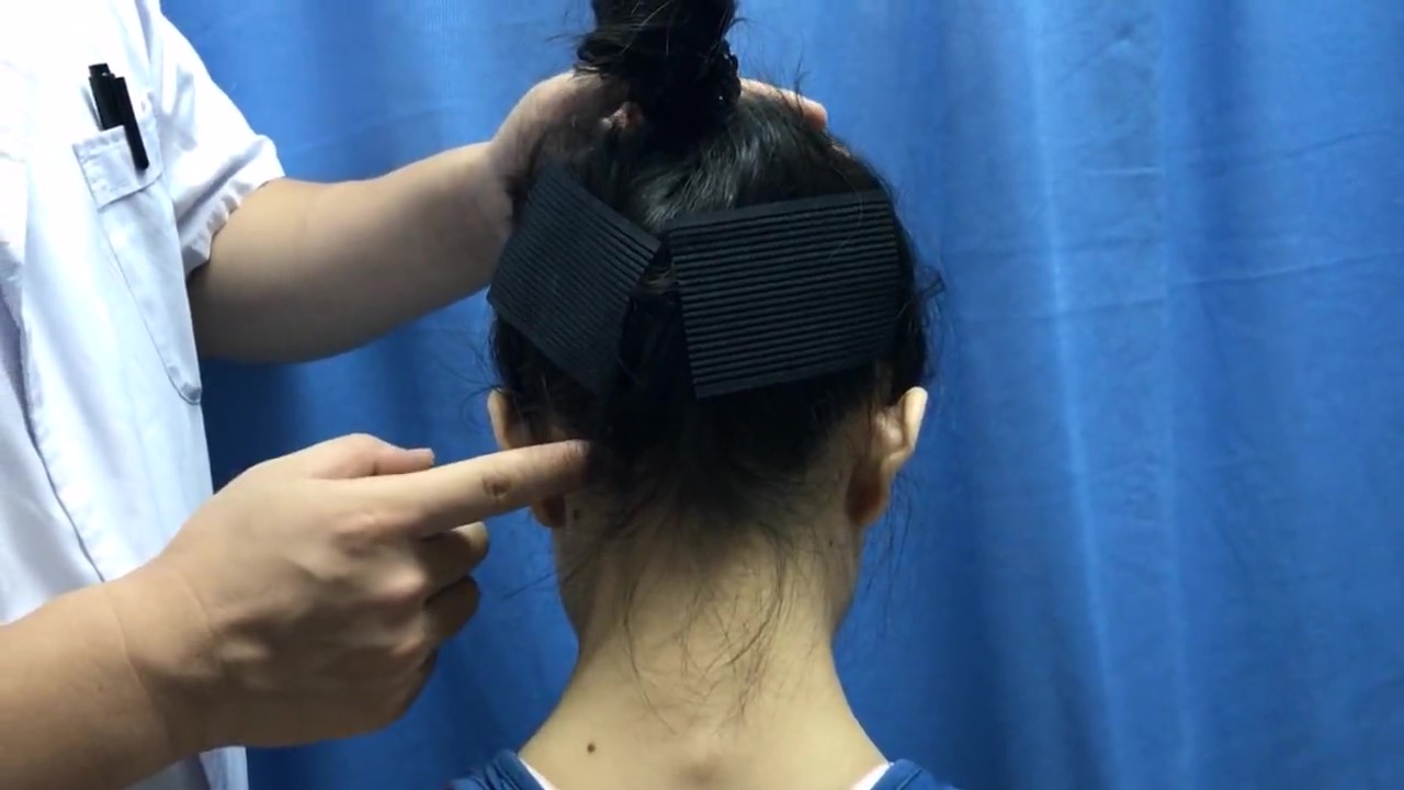 风池穴