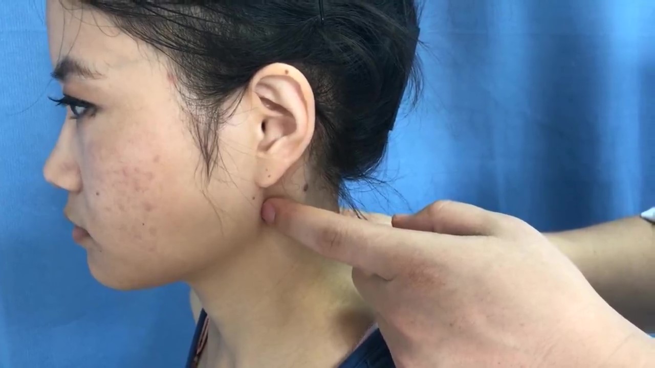 天容穴