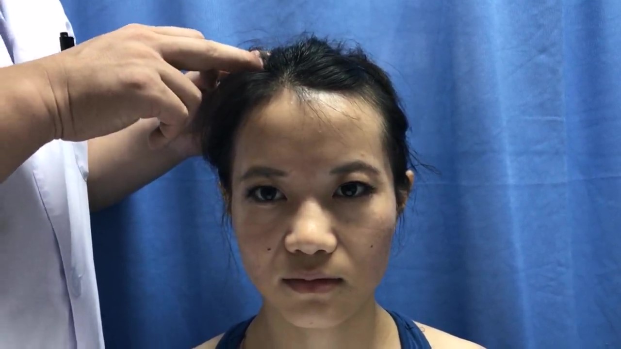 目窗穴