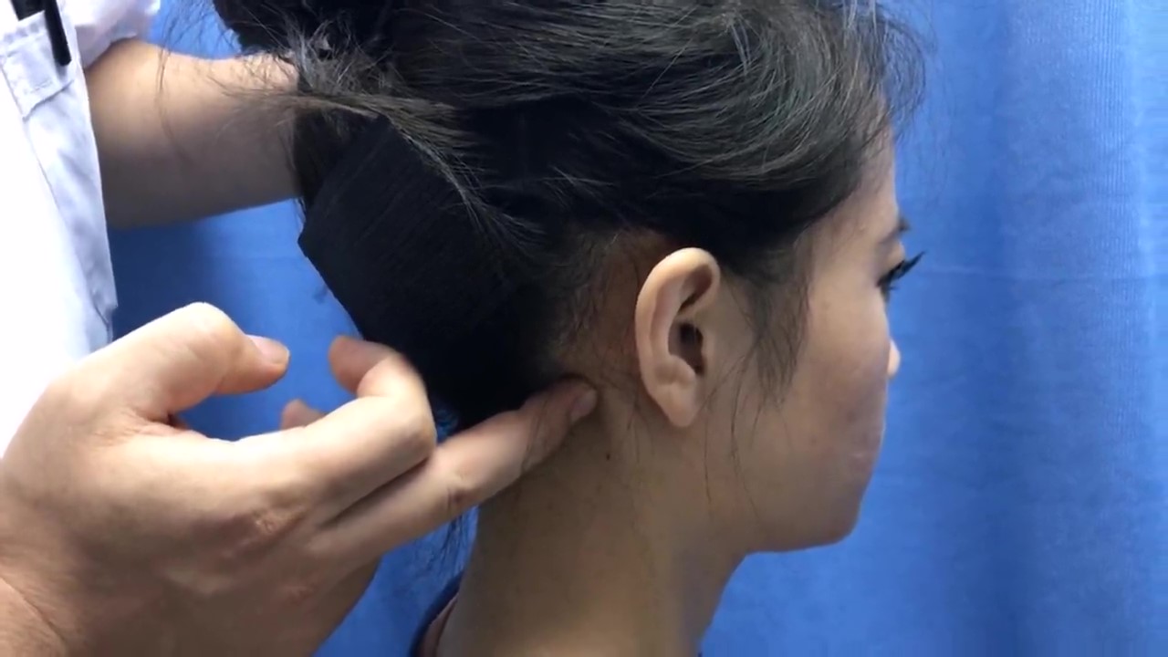 完骨穴