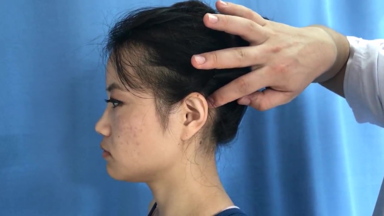 颅息穴